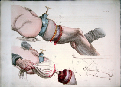 Surgical Techniques